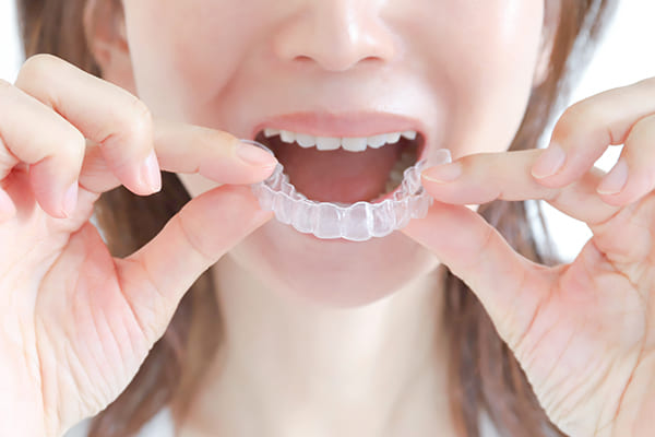 大人の矯正歯科イメージ